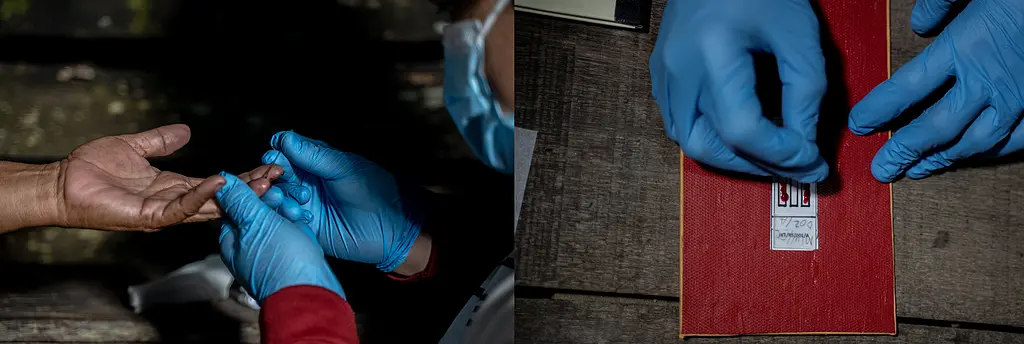 Left: collecting blood sample. Right: putting it on microscope