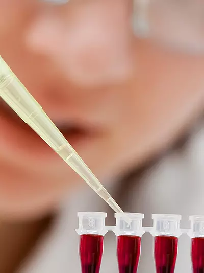 Close-up of a lab technician pipetting samples