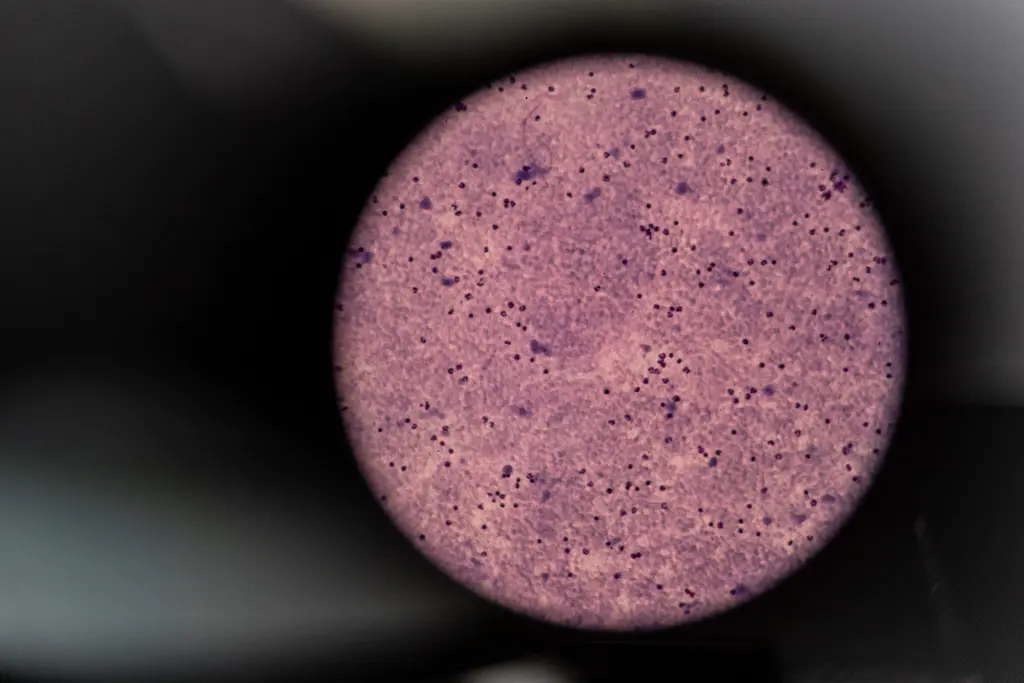 Blood sample through a microscope lens