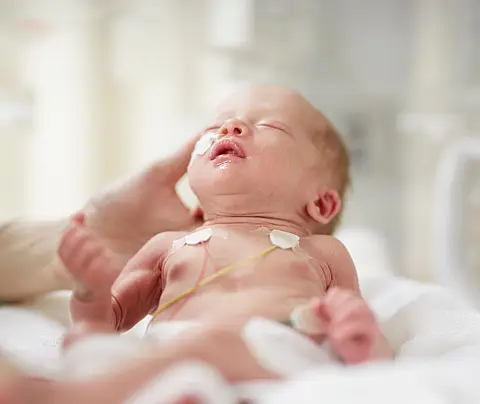 Preterm infant