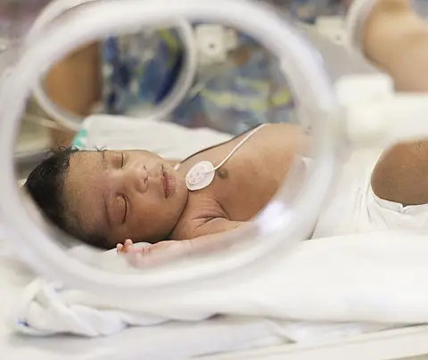 Newborn baby in hospital