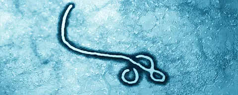 An image of the Ebola virus as seen under a microscope.